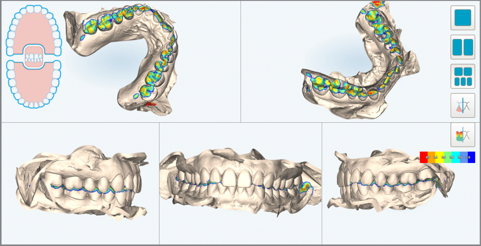 iTero Element Scanners All Smiles